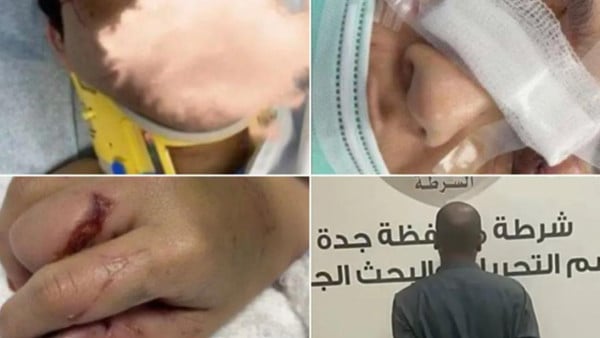 ضربها زوجها حتى فقدت بصرها..الحكم النهائي في قضية “معنفة جدة”