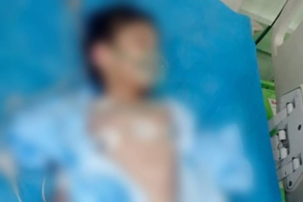 بعد موسى.. طفل عراقيٌّ جديد يقع ضحية زوجة أبيه بتعذيب مروّع